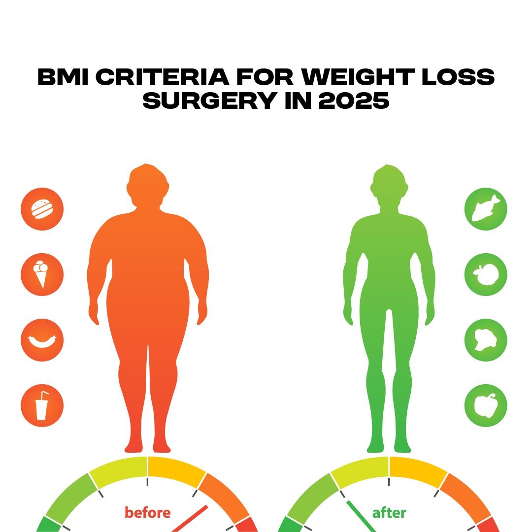 BMI Criteria for Weight Loss Surgery in 2025